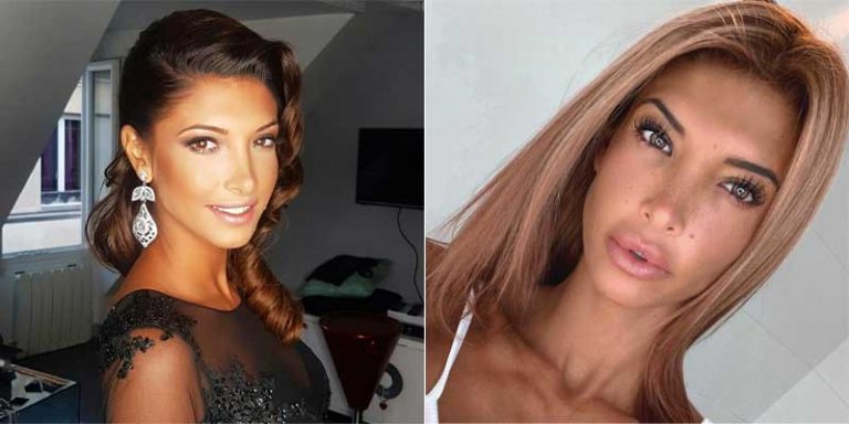 Comment Glow Up Mentalement Et Physiquement Comment glow up en 10 leçons : N°4- Les lèvres - Bientôt parfaite
